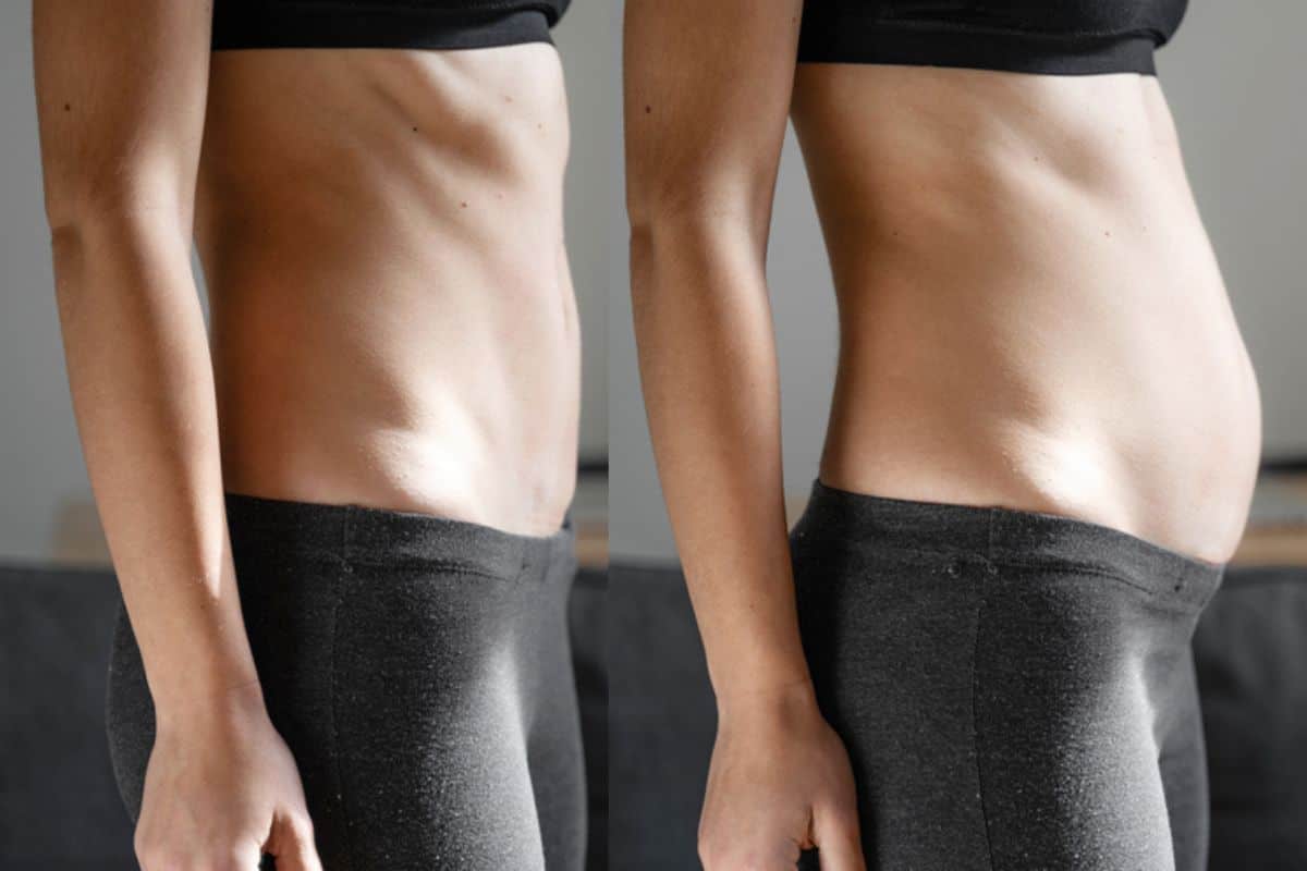 How long does diastasis recti take to improve Wantage?