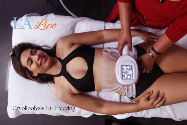 woman getting cryolipolysis Wantage