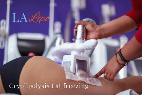 women getting fat freezing Wantage
