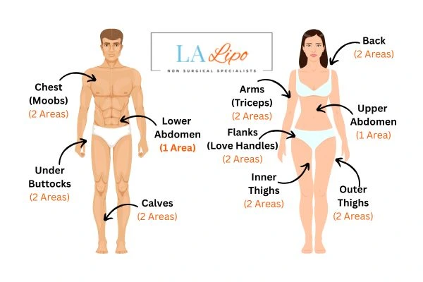 LA LIPO Cryolipolysis Areas Wantage